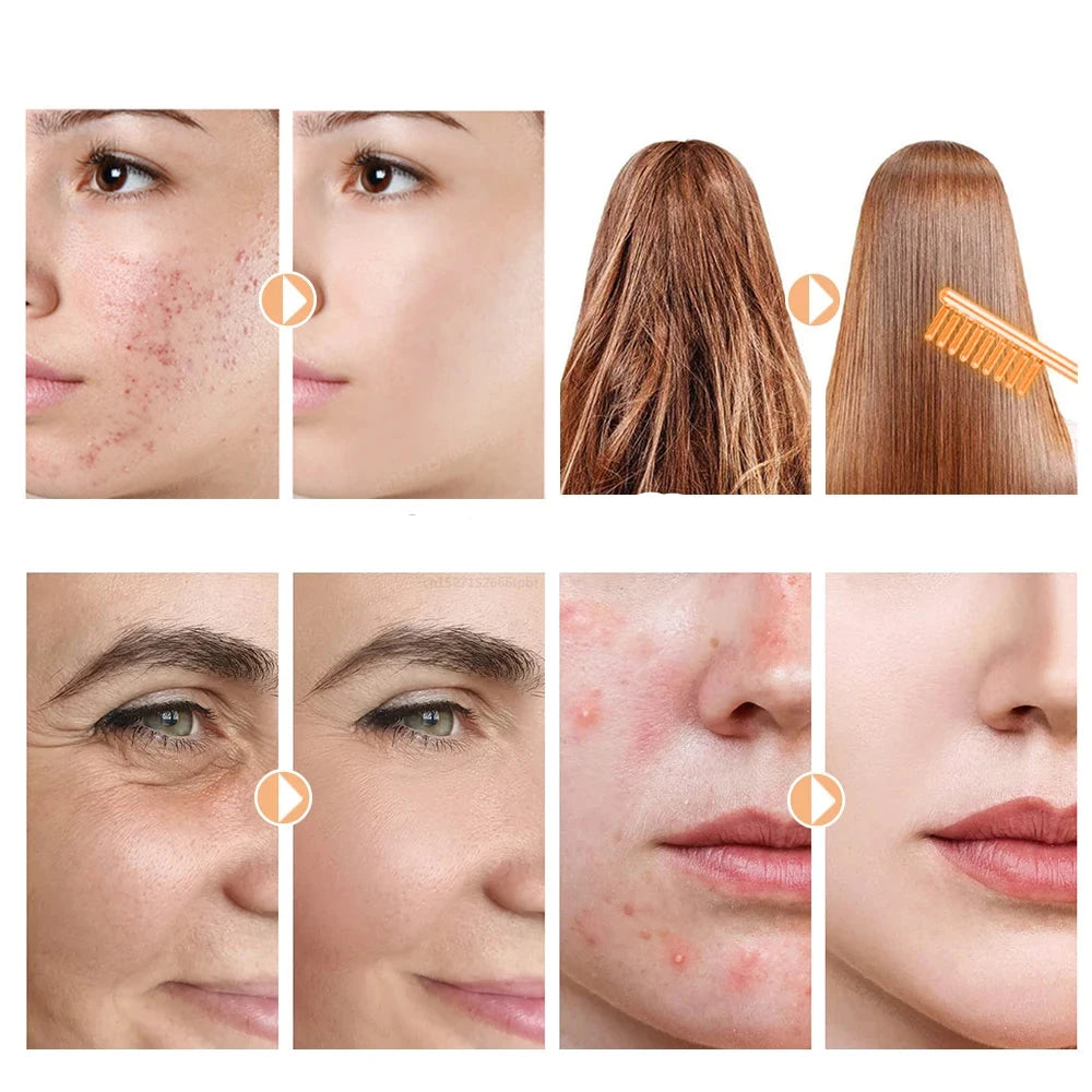 GlowWave - Wysokoczęstotliwościowa elektroda do ujędrniania skóry i usuwania zmarszczek