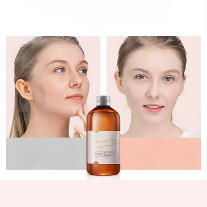 RoseHydra Mist - Tónico de agua de rosa nutritivo para el cuidado de la piel seca