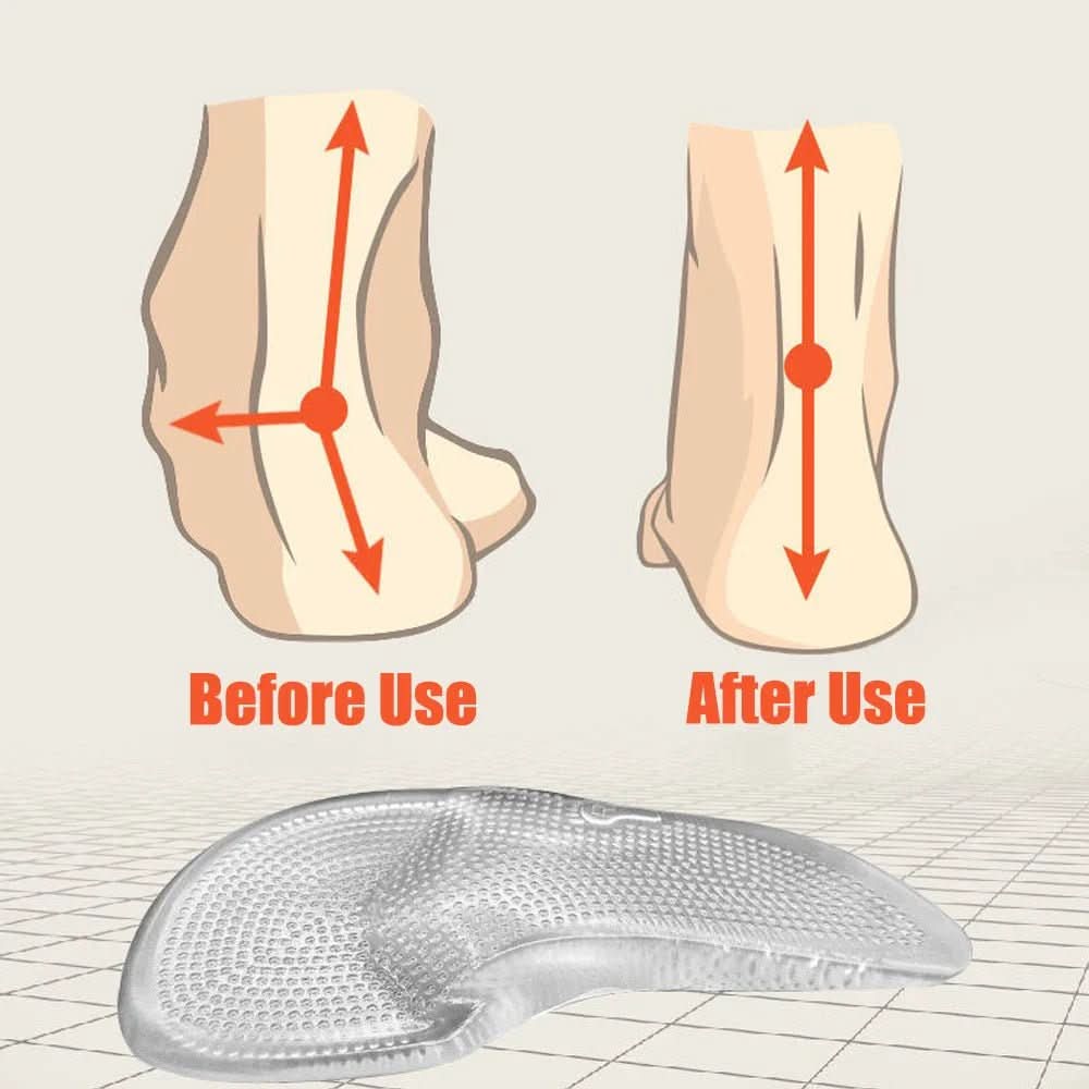 FASCIAFIX – Orthopedic gel insoles for plantar fasciitis relief 5