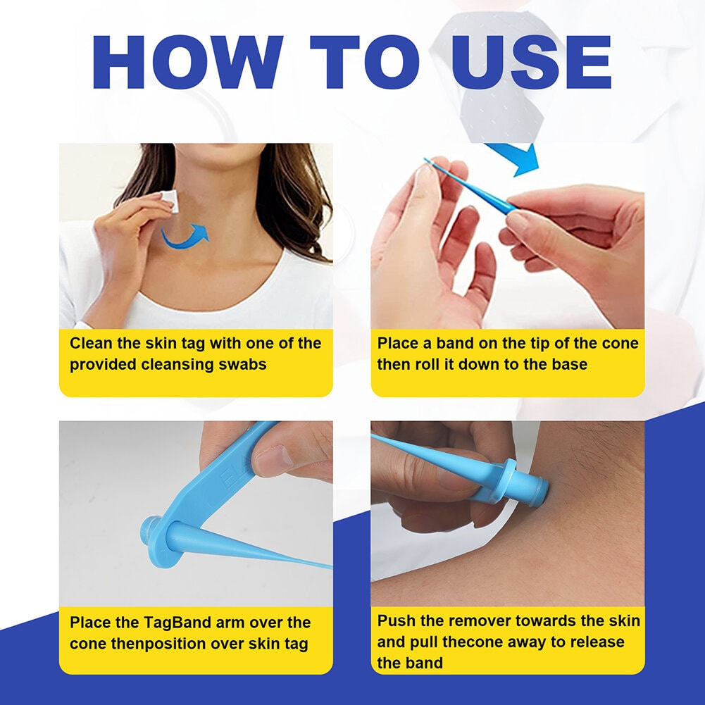 Skin Tag Removal Kit - 2-in-1 Silicone Band Ligation System for Safe Home Use-4