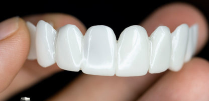 Vivolux | Dental prosthetics 3