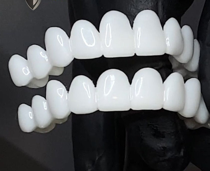 Vivolux | Dental prosthetics 4