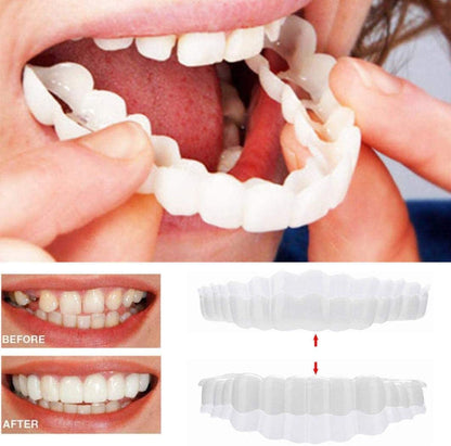 Vivolux | On Smile Veneers (upper and lower jaw included) 0