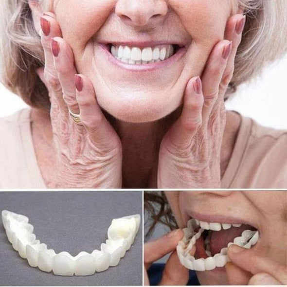 Vivolux | On Smile Veneers (upper and lower jaw included) 1